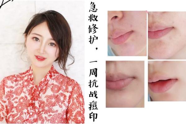 脸上长毛风水