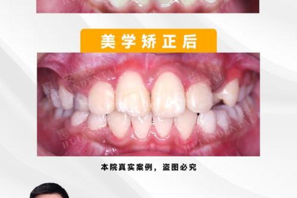 门牙外斜风水