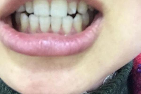 门牙外斜风水