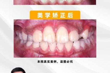 门牙外斜风水