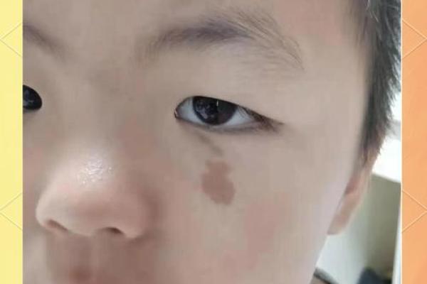 胎记如何算命-