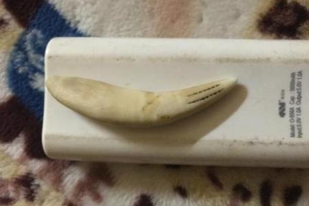 虎牙算命：面相虎牙分析