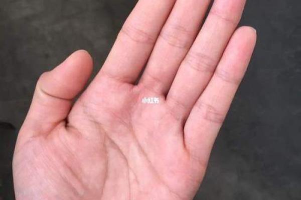 耳朵上的胎记算命分析 耳朵上的胎记算命分析